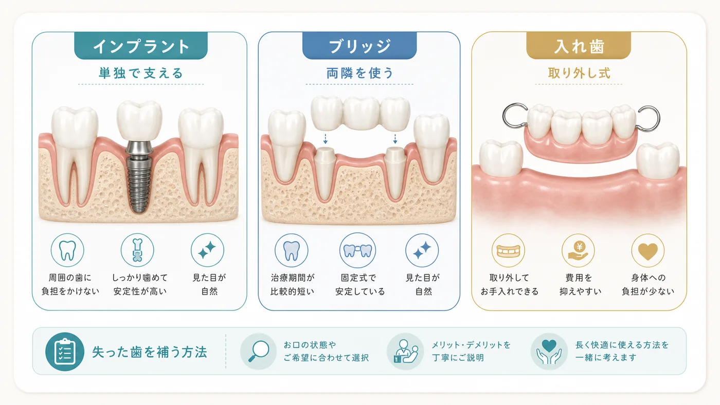 インプラント・入れ歯・ブリッジの比較