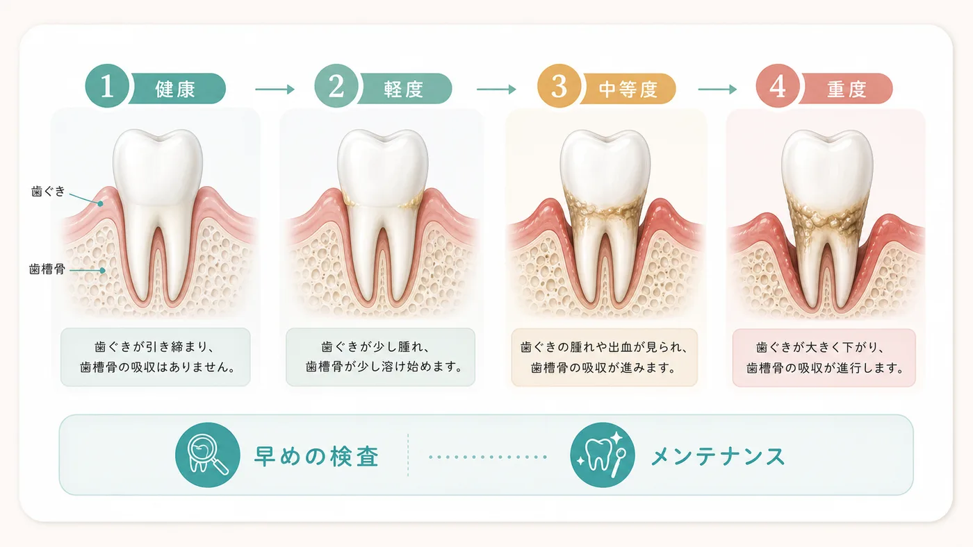 歯周病の進行段階